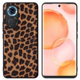 Skal Honor 70 Leopard