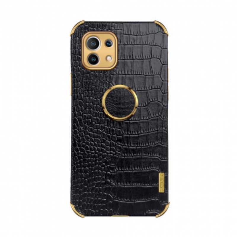 Skal Xiaomi Mi 11 (5G) X-case Krokodilskinnseffekt